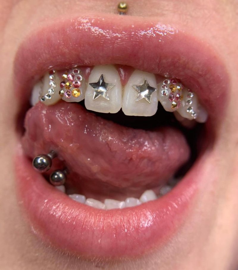 Las gemas dentales, la tendencia que viene con todo