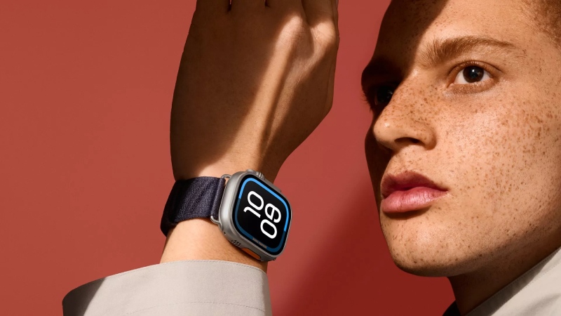 accesorios de moda para un smart watch